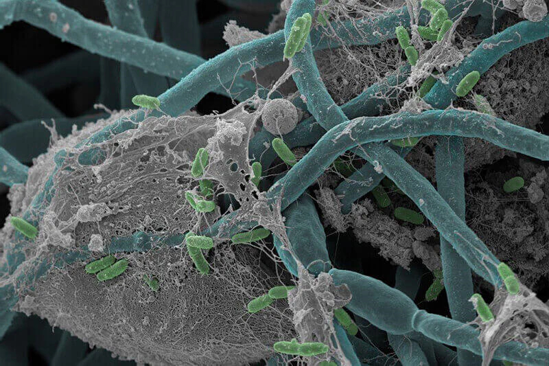 Interaction of bacteria and saccharomyces albicans in the gut Interaction of bacteria and saccharomyces albicans in the gut
